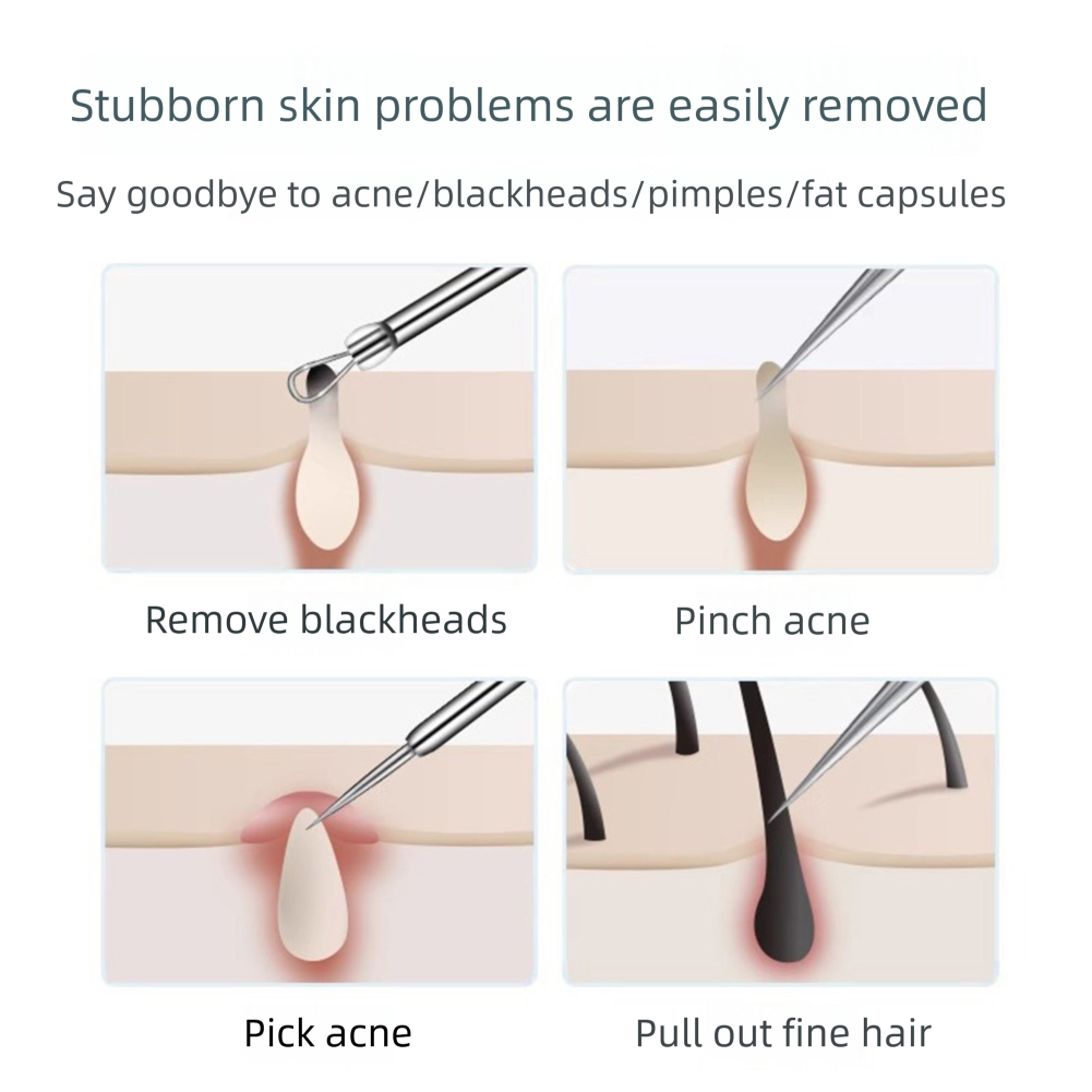 3-5pcs Ingrown Hair Tweezers A - Hair Care Clinic 评论和价格