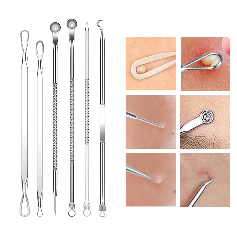 4-11Pcs Ingrown Hair Tweezers  - Hair Care Clinic 评论和价格