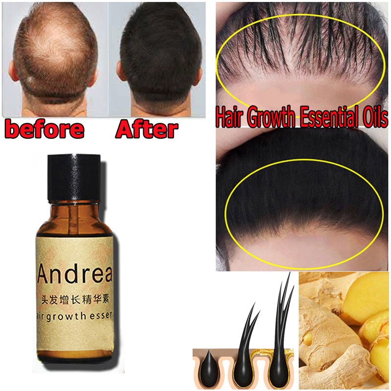 2/5/10Pcs Andrea Hair Growth S - Hair Care Herbal Products 评论和价格
